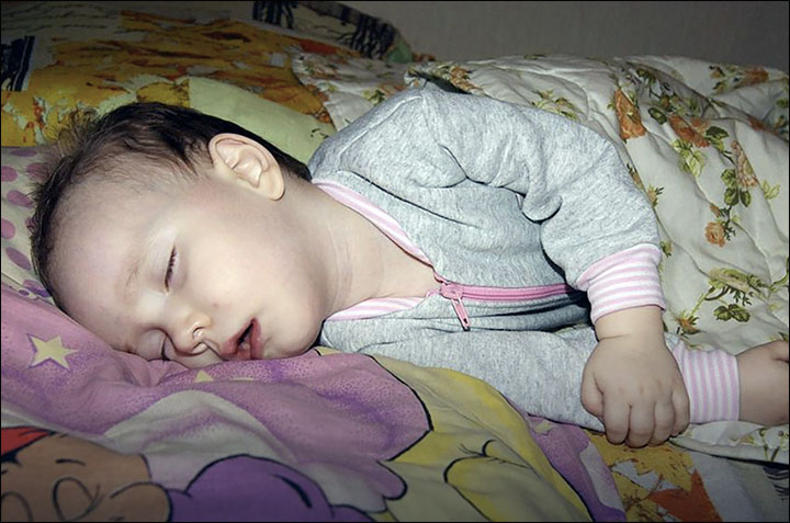 Medics Seek Cure For One-and-a-half Year Old 'Sleeping Beauty' Girl Who ...